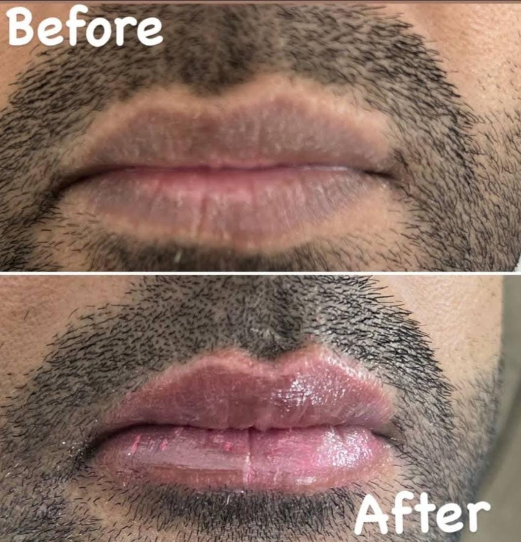 Before and after treatment comparison